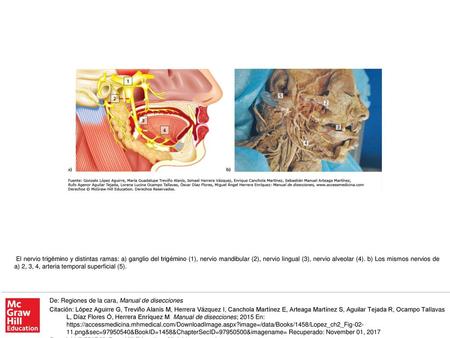 El nervio trigémino y distintas ramas: a) ganglio del trigémino (1), nervio mandibular (2), nervio lingual (3), nervio alveolar (4). b) Los mismos nervios.