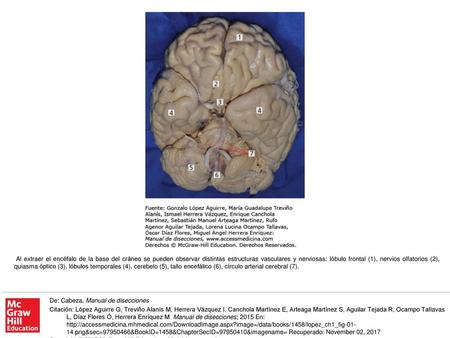 Al extraer el encéfalo de la base del cráneo se pueden observar distintas estructuras vasculares y nerviosas: lóbulo frontal (1), nervios olfatorios (2),