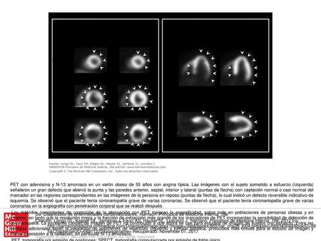 PET, tomografía por emisión de positrones; SPECT, tomografía computarizada por emisión de fotón único. De: Diagnóstico de enfermedades cardiovasculares,