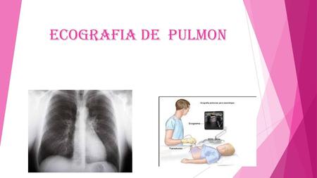 ECOGRAFIA DE PULMON.