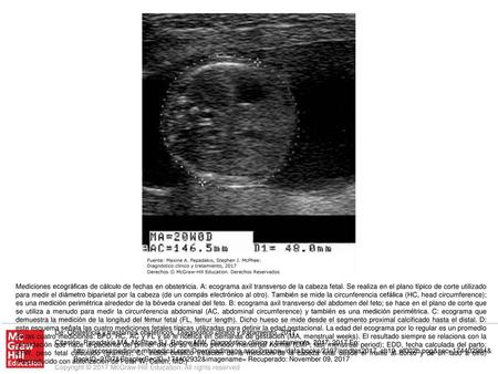 Mediciones ecográficas de cálculo de fechas en obstetricia