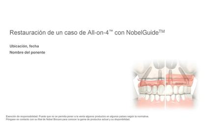 Restauración de un caso de All-on-4™ con NobelGuideTM