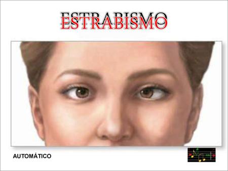 ESTRABISMO ESTRABISMO