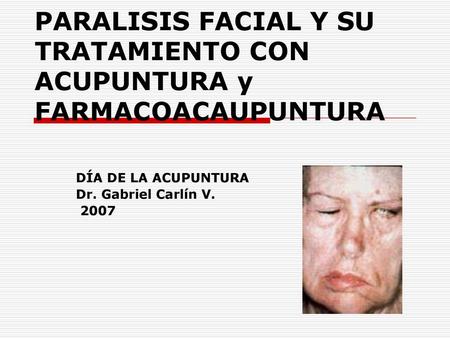 PARALISIS FACIAL Y SU TRATAMIENTO CON ACUPUNTURA y FARMACOACAUPUNTURA