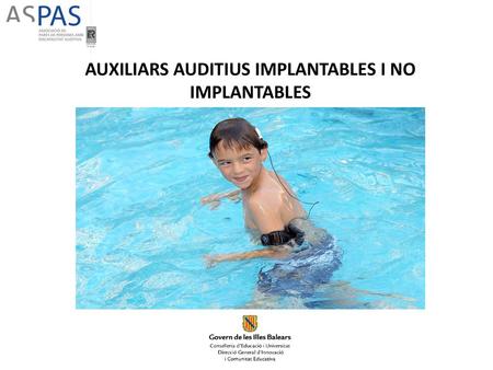 AUXILIARS AUDITIUS IMPLANTABLES I NO IMPLANTABLES