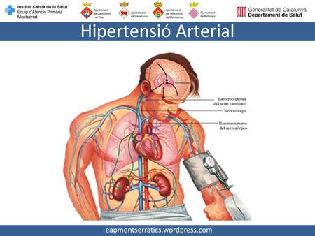Hipertensió Arterial.