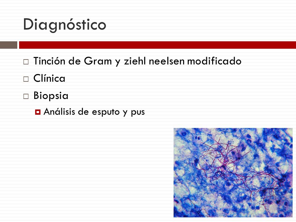 Diagnóstico Tinción de Gram y ziehl neelsen modificado Clínica Biopsia