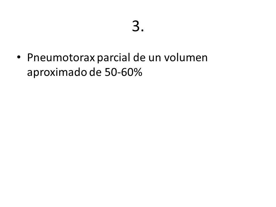 3. Pneumotorax parcial de un volumen aproximado de 50-60%