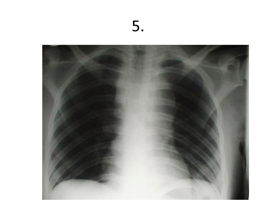 5.