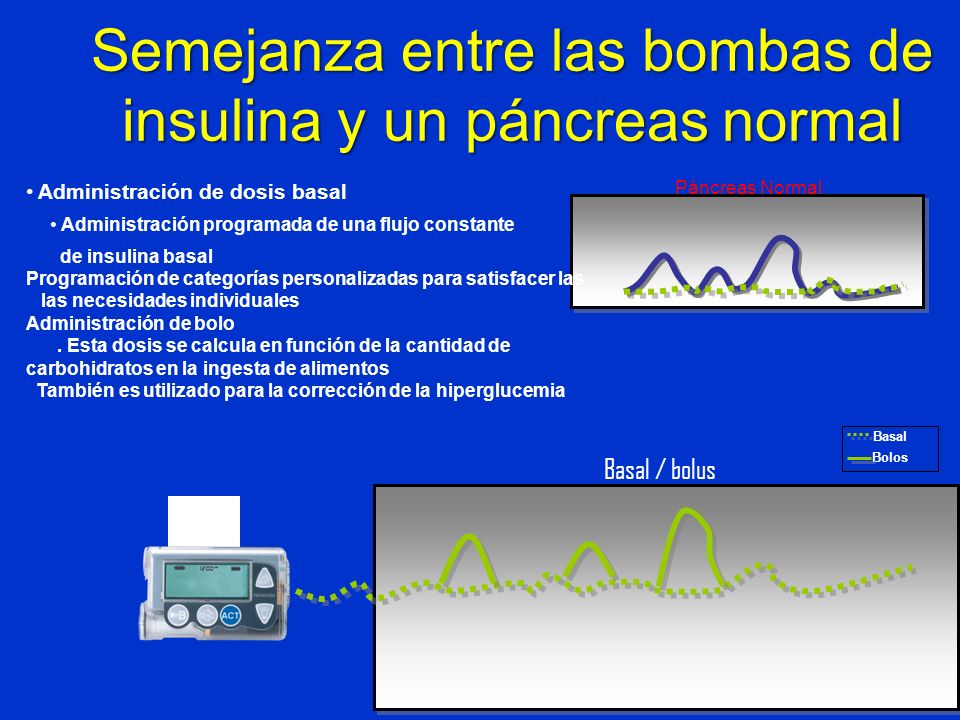 Semejanza entre las bombas de insulina y un páncreas normal