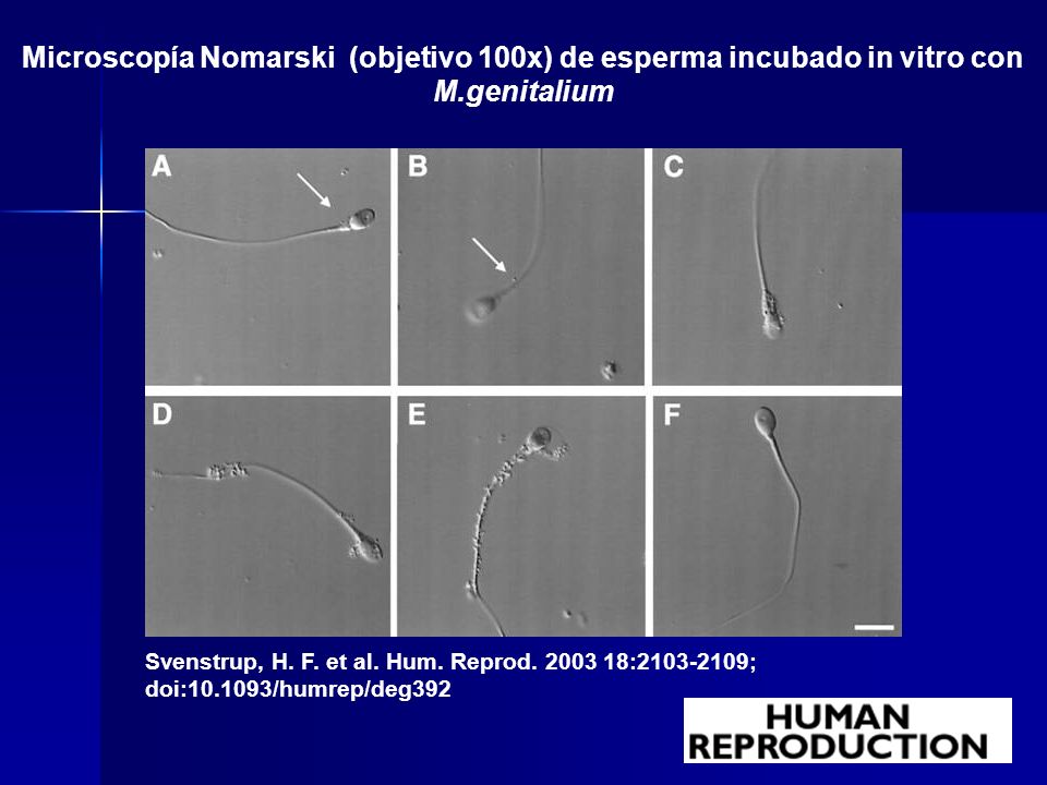 Microscopía Nomarski (objetivo 100x) de esperma incubado in vitro con M.genitalium