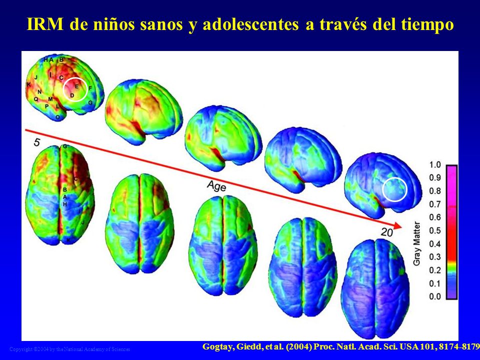IRM de niños sanos y adolescentes a través del tiempo