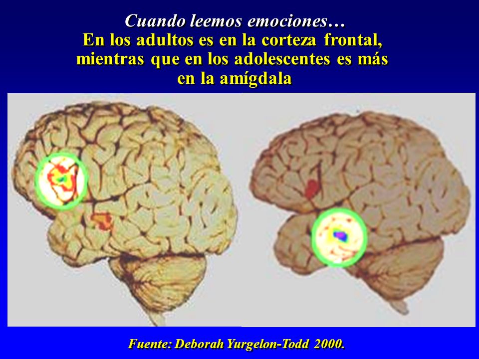 Cuando leemos emociones… En los adultos es en la corteza frontal,