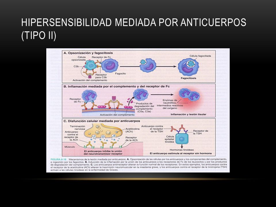 HIPERSENSIBILIDAD MEDIADA POR ANTICUERPOS (TIPO II)