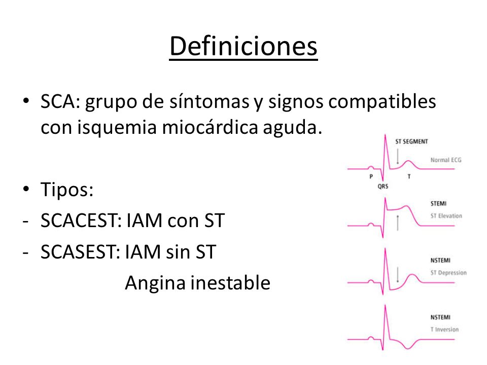 Definiciones SCA: grupo de síntomas y signos compatibles con isquemia miocárdica aguda. Tipos: SCACEST: IAM con ST.