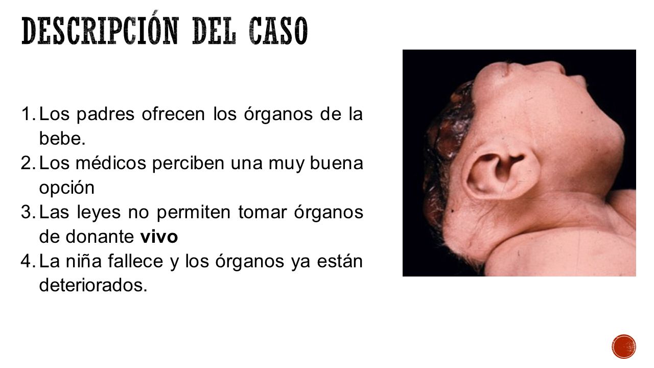 Descripción del caso Los padres ofrecen los órganos de la bebe.