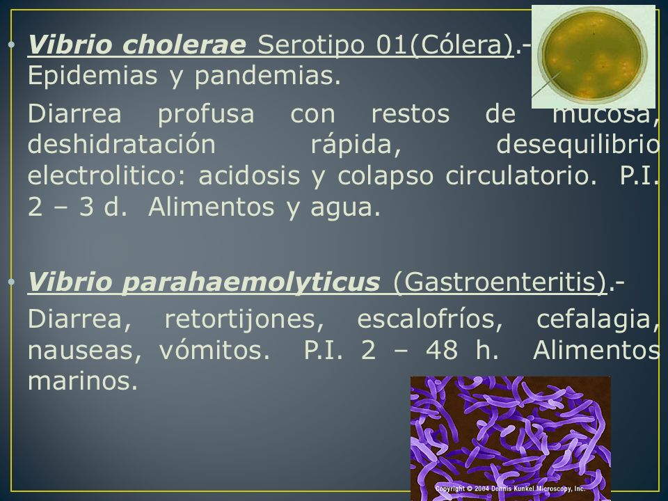 Vibrio cholerae Serotipo 01(Cólera).- Epidemias y pandemias.