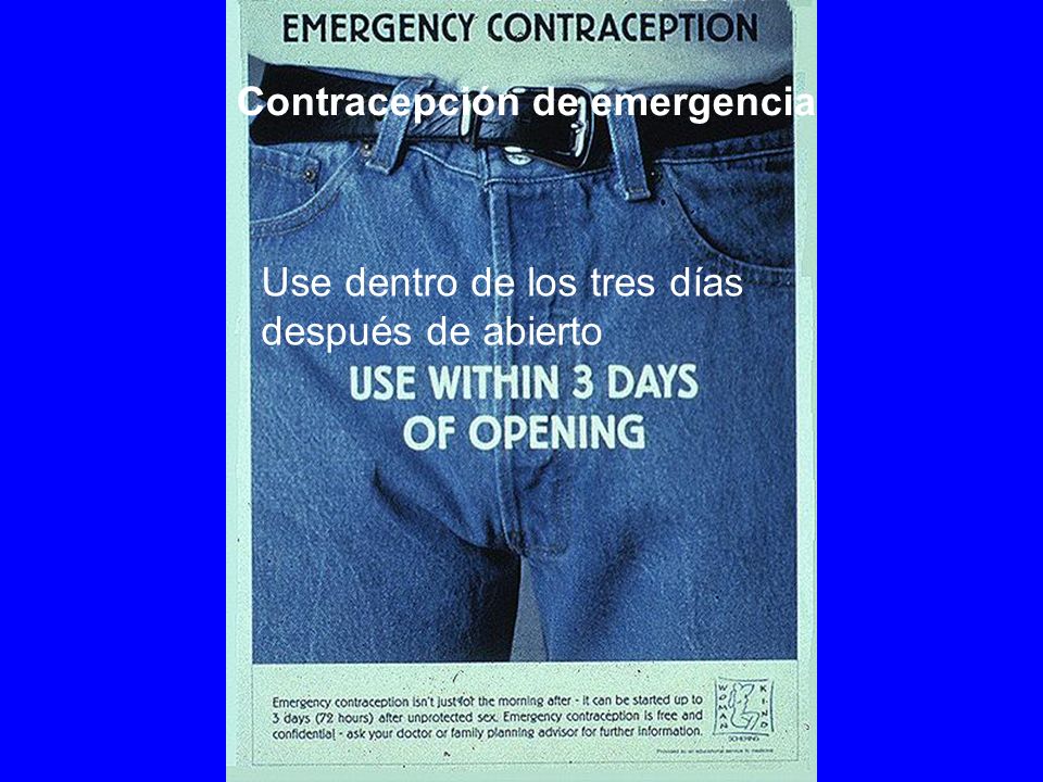 Contracepción de emergencia