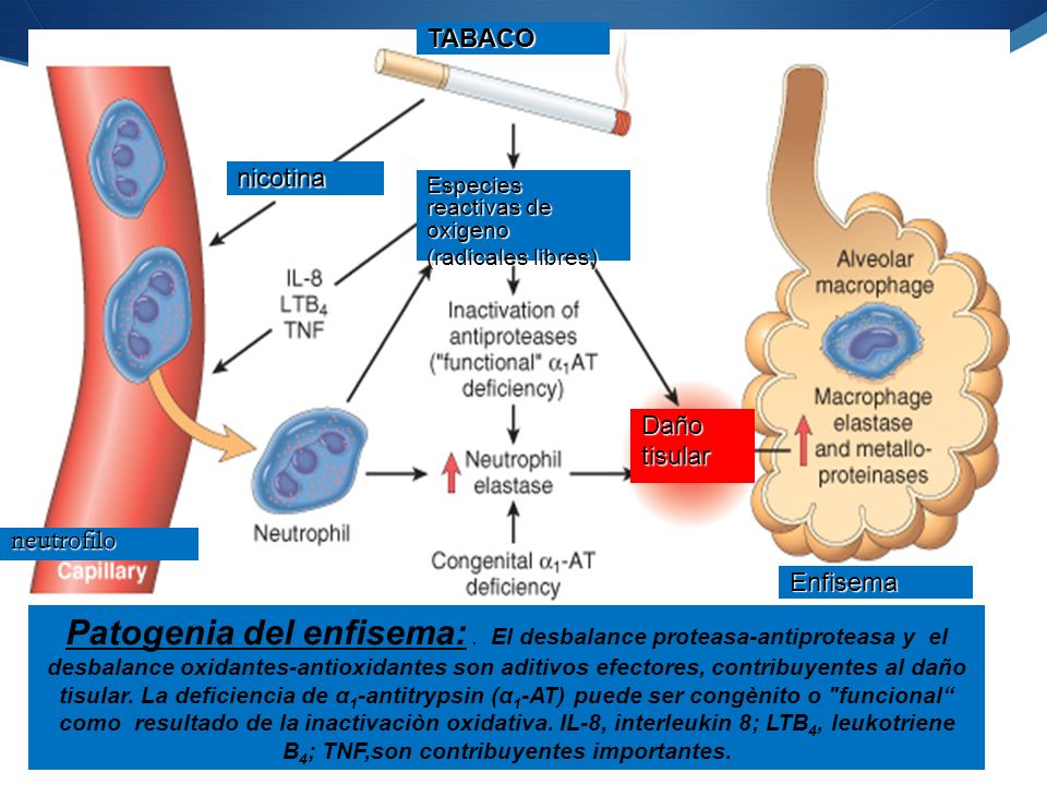 TABACO nicotina. Especies reactivas de oxigeno. (radicales libres) Daño. tisular. neutrofilo. Enfisema.