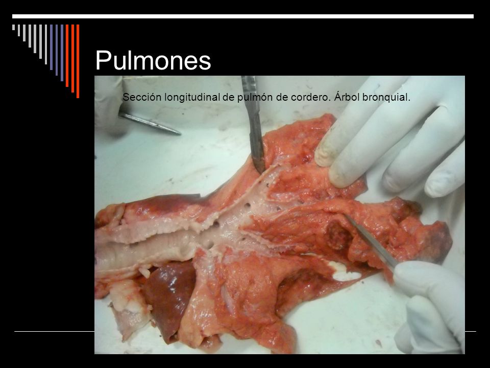 Pulmones Sección longitudinal de pulmón de cordero. Árbol bronquial.