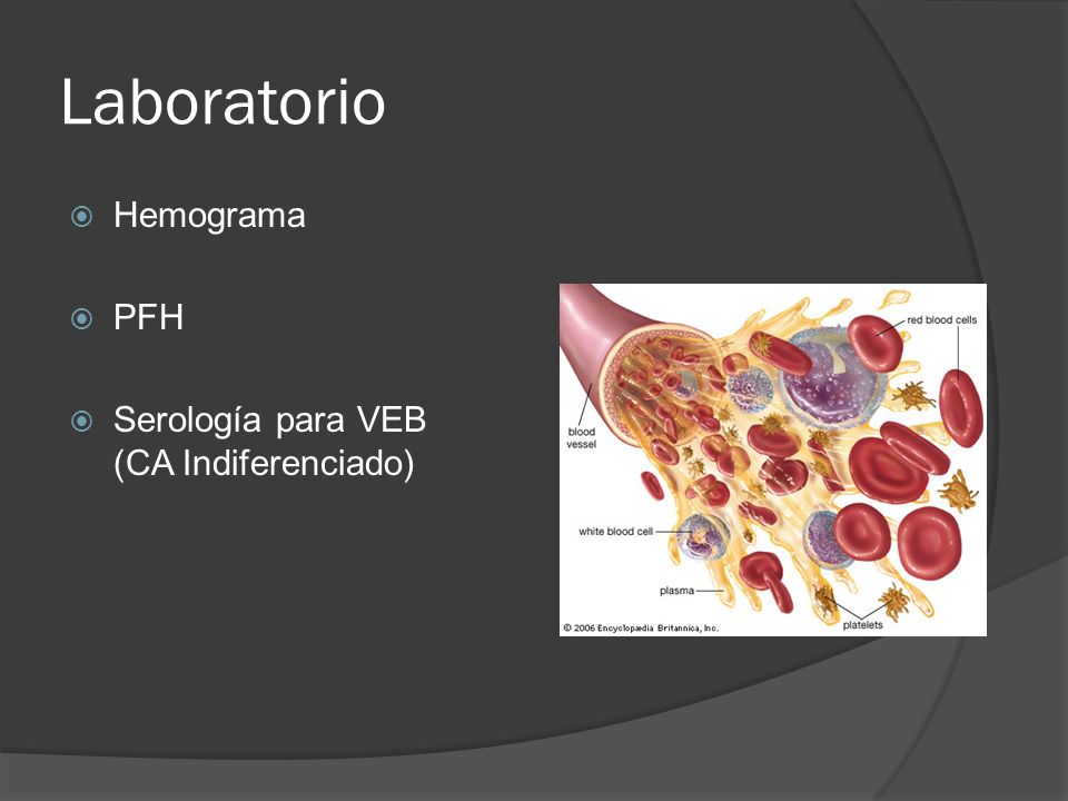 Laboratorio Hemograma PFH Serología para VEB (CA Indiferenciado)