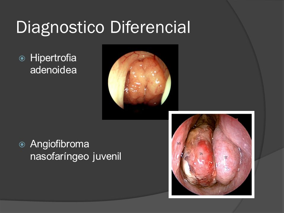 Diagnostico Diferencial