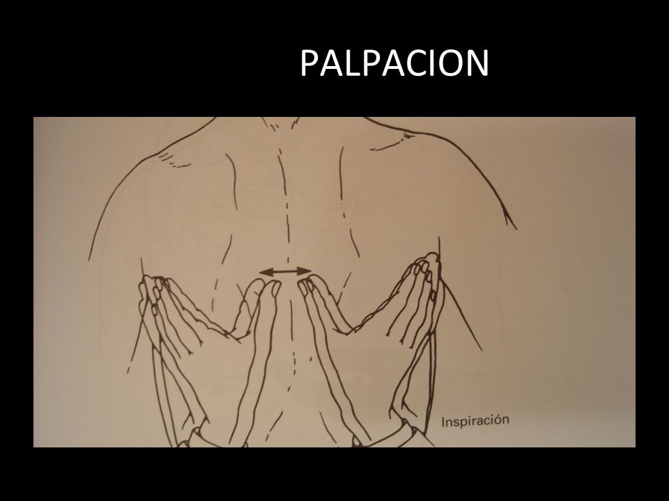 PALPACION