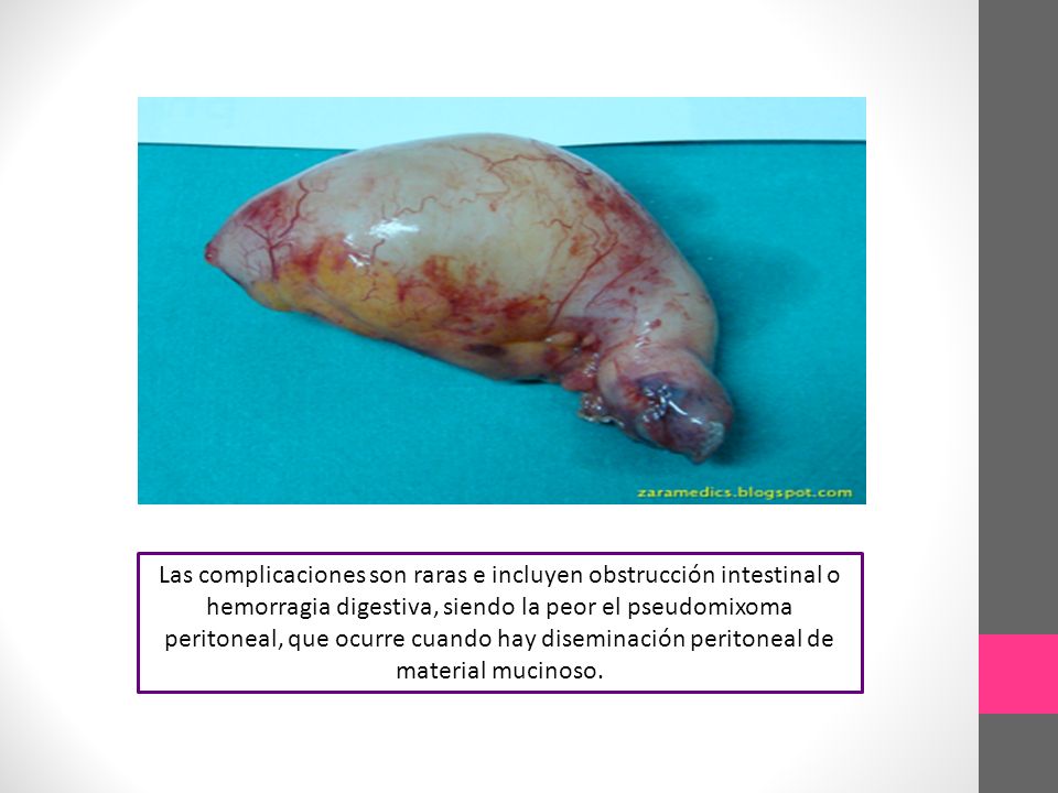 Las complicaciones son raras e incluyen obstrucción intestinal o hemorragia digestiva, siendo la peor el pseudomixoma peritoneal, que ocurre cuando hay diseminación peritoneal de material mucinoso.