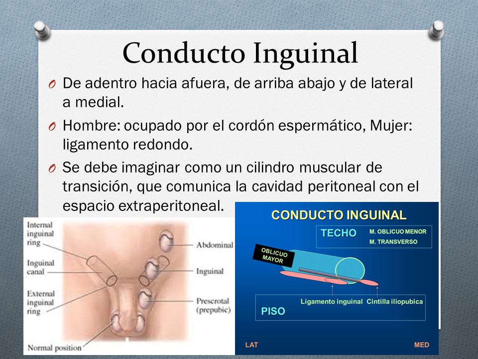 Conducto Inguinal De adentro hacia afuera, de arriba abajo y de lateral a medial.