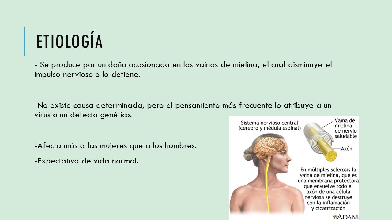 Etiología - Se produce por un daño ocasionado en las vainas de mielina, el cual disminuye el impulso nervioso o lo detiene.