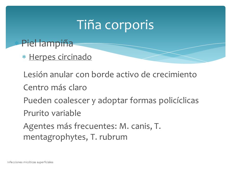Tiña corporis Piel lampiña Herpes circinado