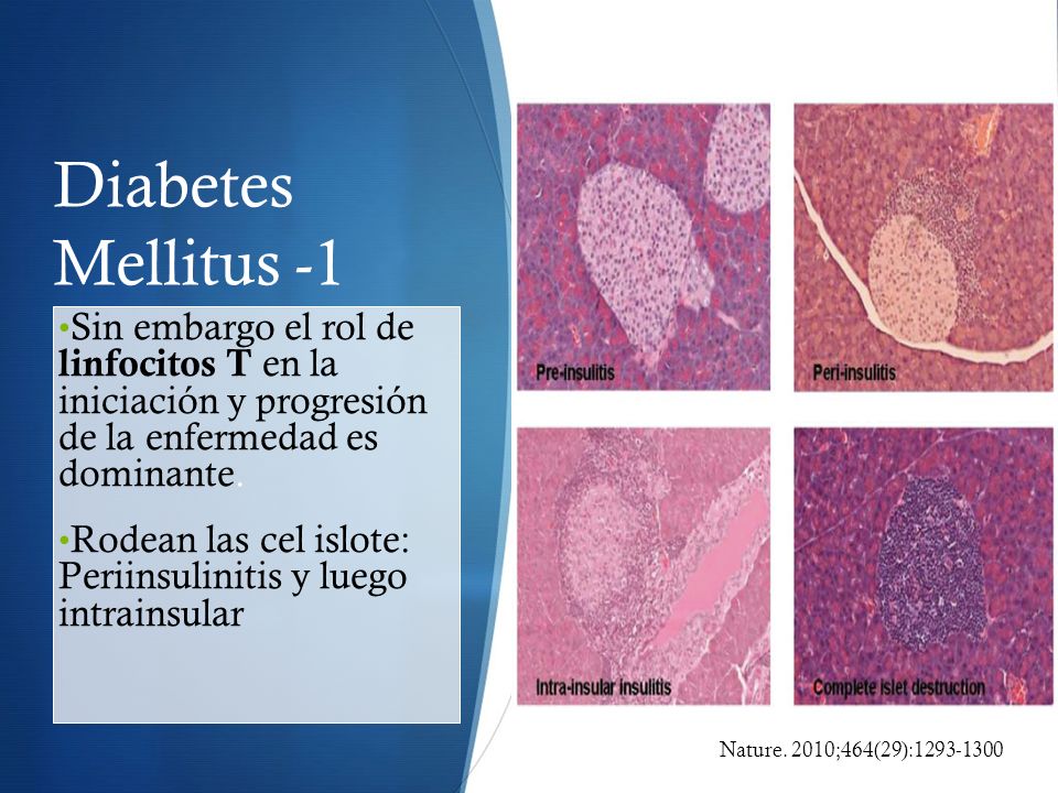 Diabetes Mellitus -1 Sin embargo el rol de linfocitos T en la iniciación y progresión de la enfermedad es dominante.