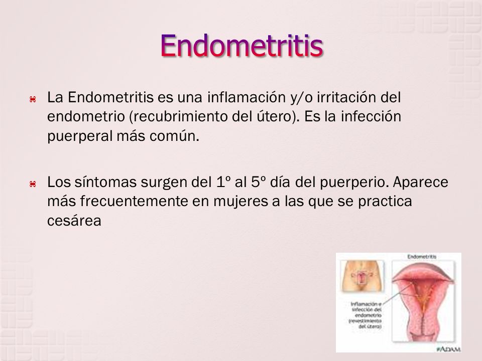 Endometritis La Endometritis es una inflamación y/o irritación del endometrio (recubrimiento del útero). Es la infección puerperal más común.