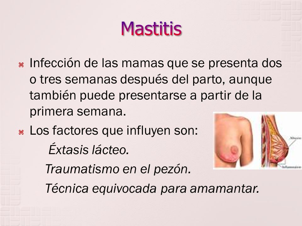 Mastitis Infección de las mamas que se presenta dos o tres semanas después del parto, aunque también puede presentarse a partir de la primera semana.