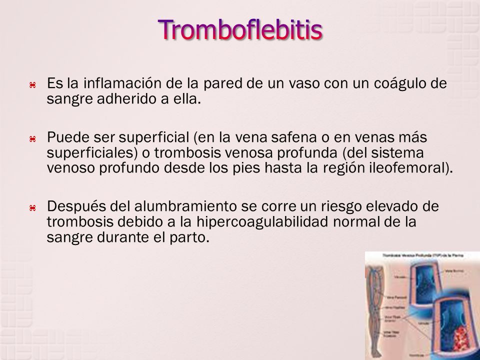 Tromboflebitis Es la inflamación de la pared de un vaso con un coágulo de sangre adherido a ella.