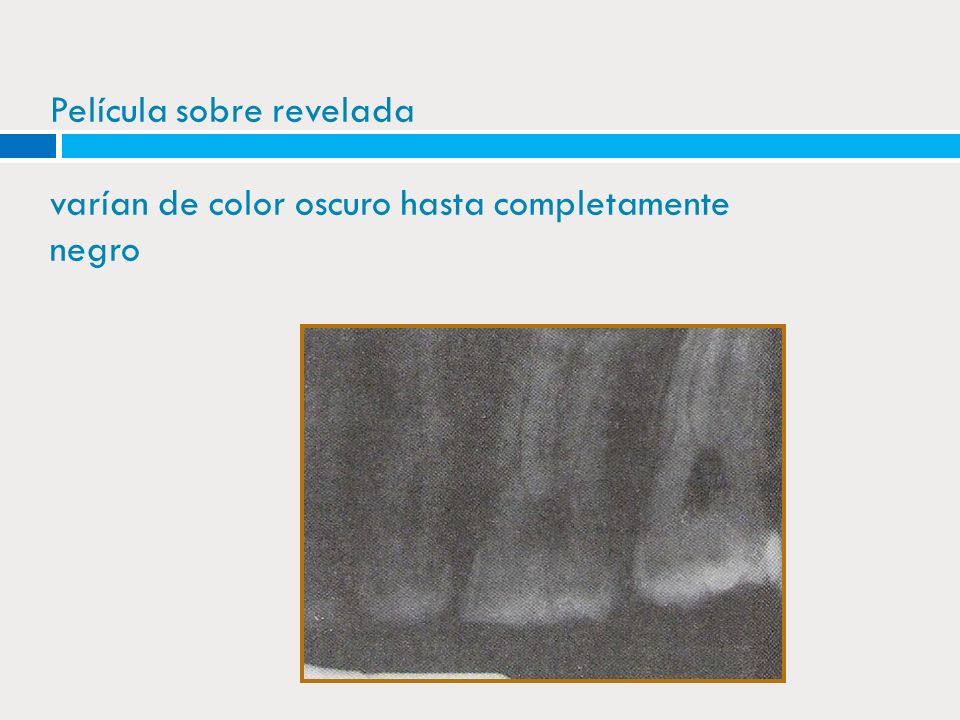 Película sobre revelada varían de color oscuro hasta completamente negro