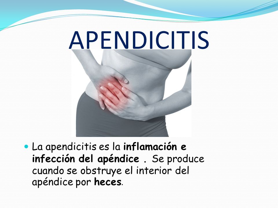 APENDICITIS La apendicitis es la inflamación e infección del apéndice .