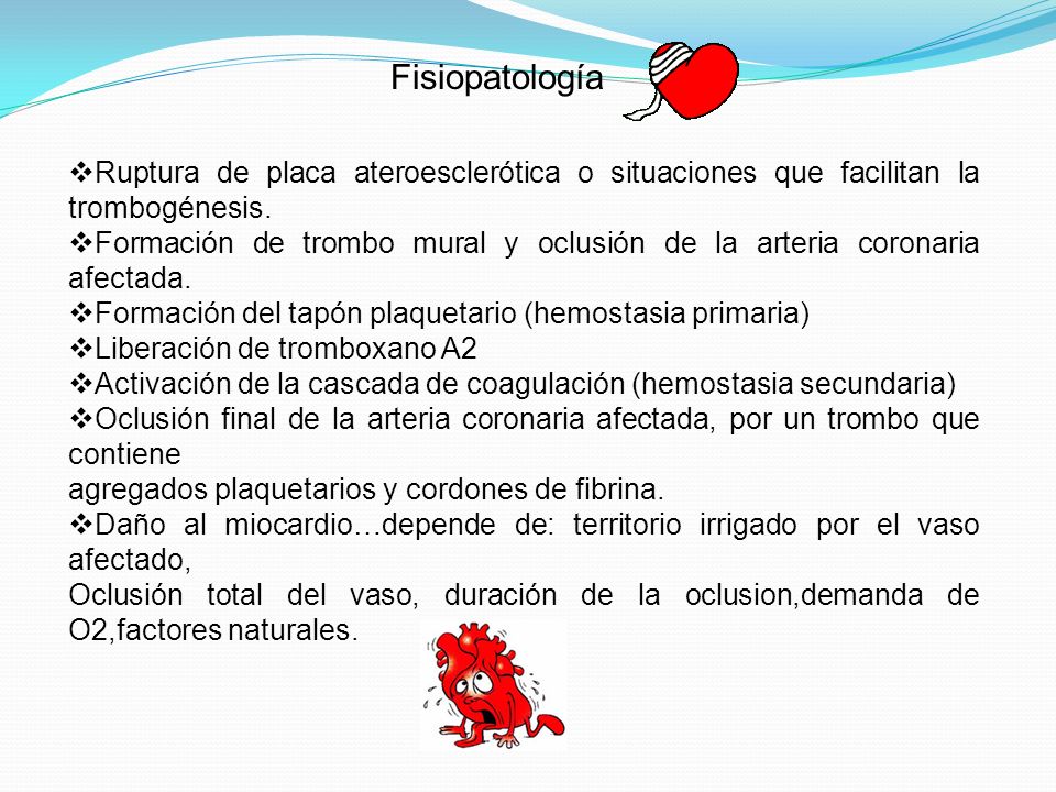 Fisiopatología Ruptura de placa ateroesclerótica o situaciones que facilitan la trombogénesis.