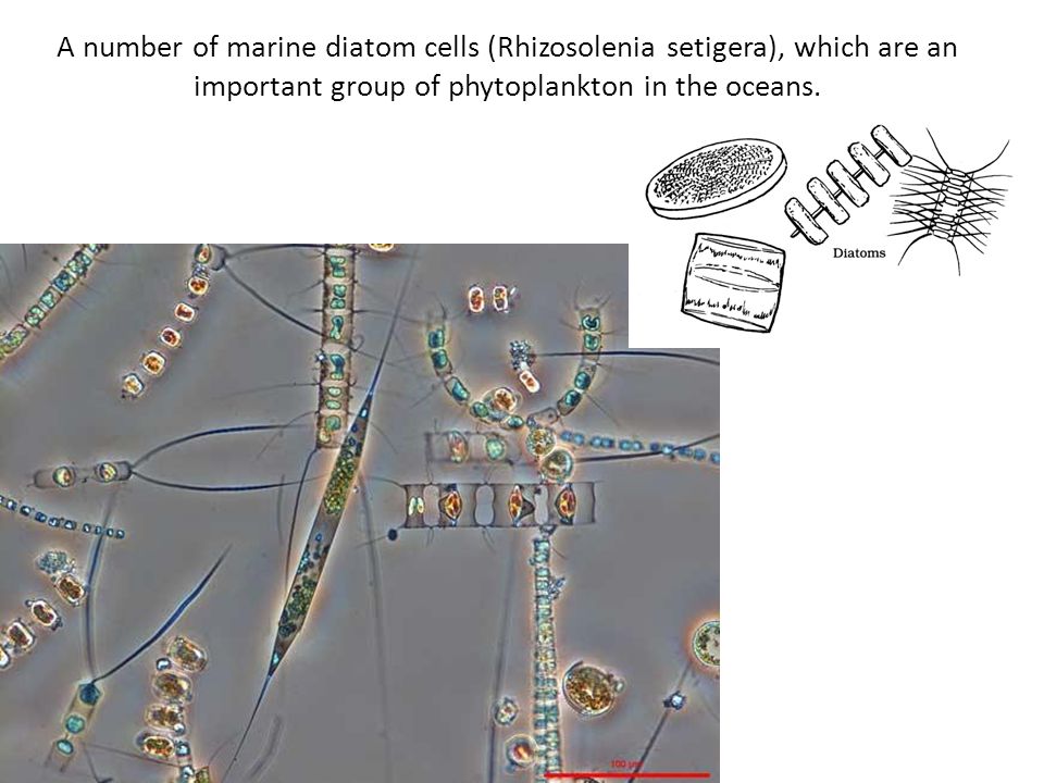 A number of marine diatom cells (Rhizosolenia setigera), which are an important group of phytoplankton in the oceans.