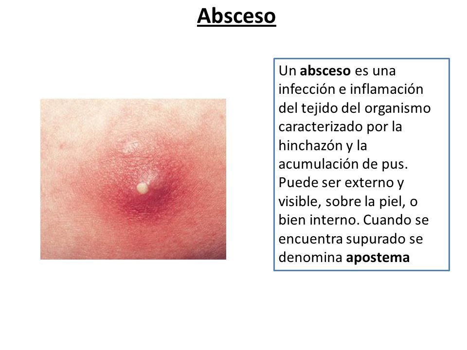 Cátedra de Anatomía Patológica. Facultad de Medicina. U. N. T.