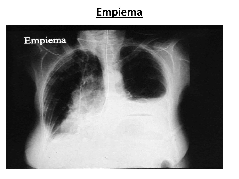 Cátedra de Anatomía Patológica. Facultad de Medicina. U. N. T.