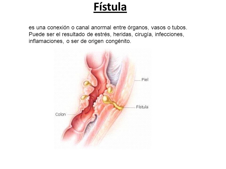 Cátedra de Anatomía Patológica. Facultad de Medicina. U. N. T.