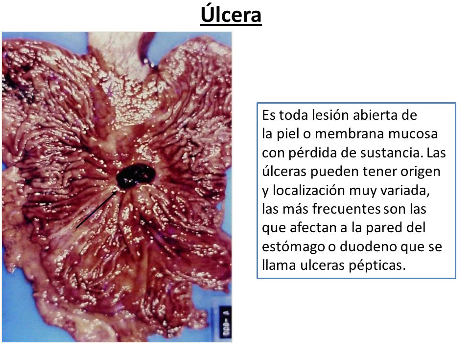 Cátedra de Anatomía Patológica. Facultad de Medicina. U. N. T.