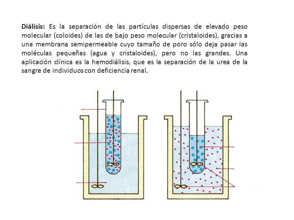 Diálisis: Es la separación de las partículas dispersas de elevado peso molecular (coloides) de las de bajo peso molecular (cristaloides), gracias a una membrana semipermeable cuyo tamaño de poro sólo deja pasar las moléculas pequeñas (agua y cristaloides), pero no las grandes.