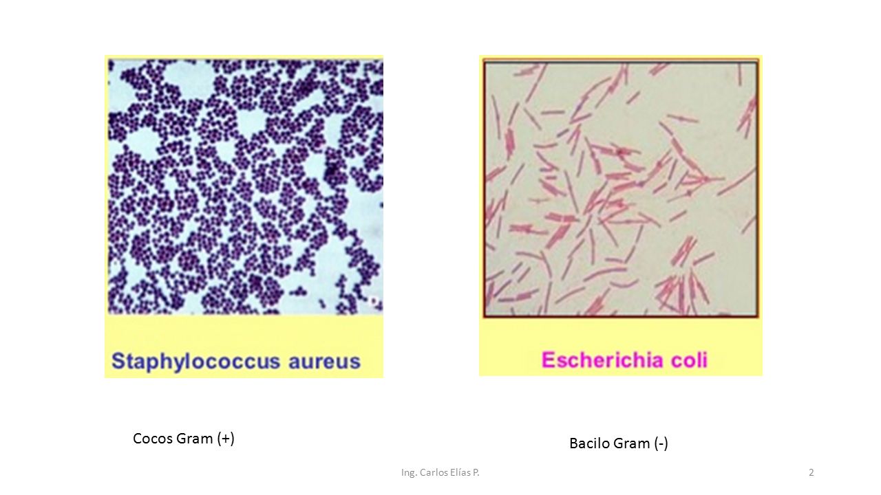 Cocos Gram (+) Bacilo Gram (-) Ing. Carlos Elías P.