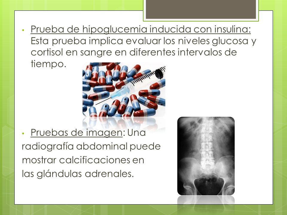 Prueba de hipoglucemia inducida con insulina: Esta prueba implica evaluar los niveles glucosa y cortisol en sangre en diferentes intervalos de tiempo.