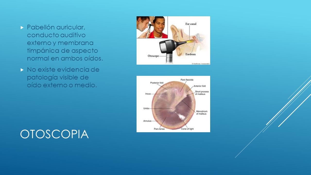 Pabellón auricular, conducto auditivo externo y membrana timpánica de aspecto normal en ambos oídos.