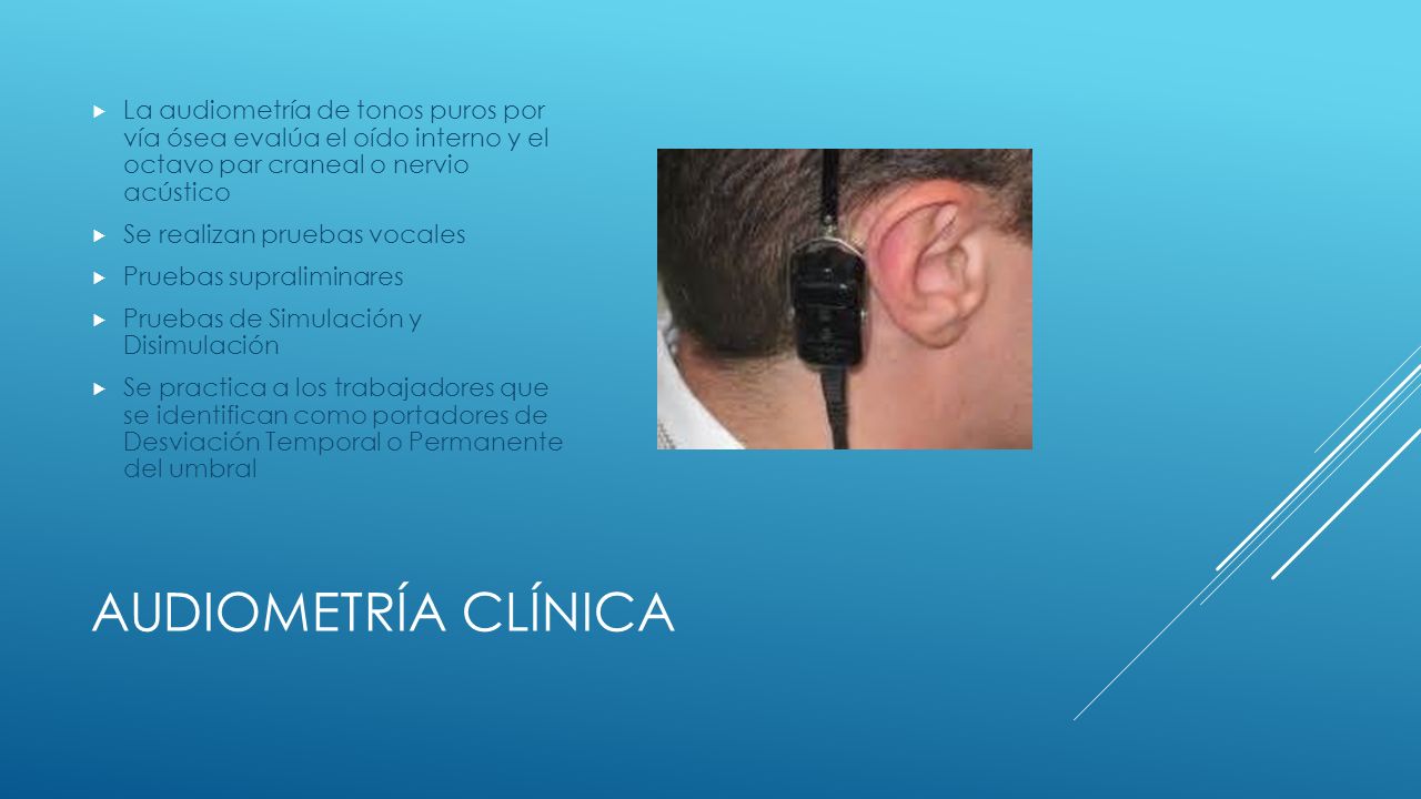 La audiometría de tonos puros por vía ósea evalúa el oído interno y el octavo par craneal o nervio acústico