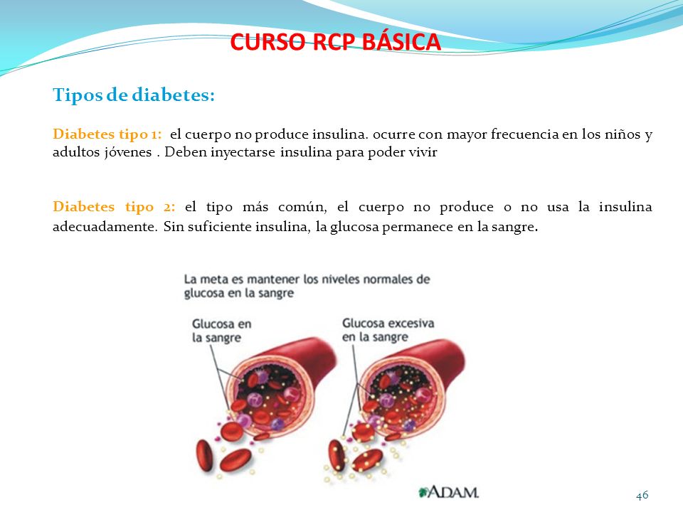 CURSO RCP BÁSICA Tipos de diabetes: