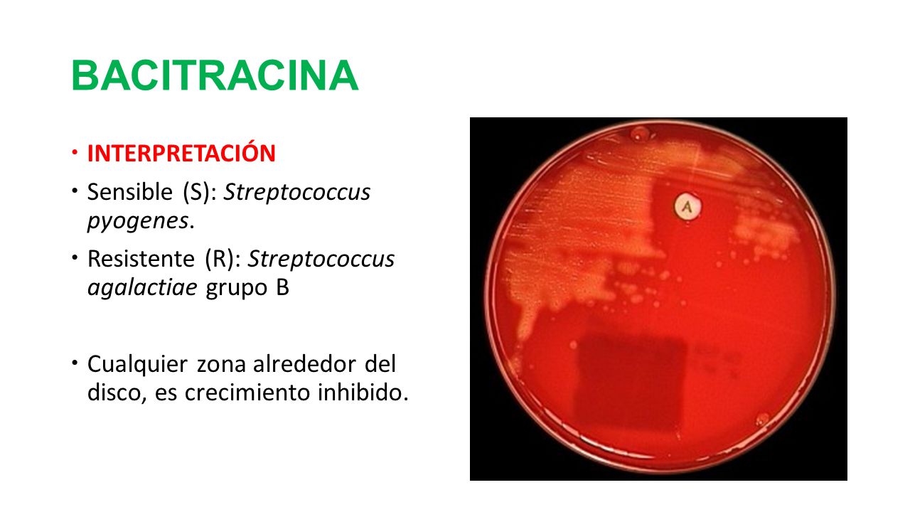 BACITRACINA INTERPRETACIÓN Sensible (S): Streptococcus pyogenes.